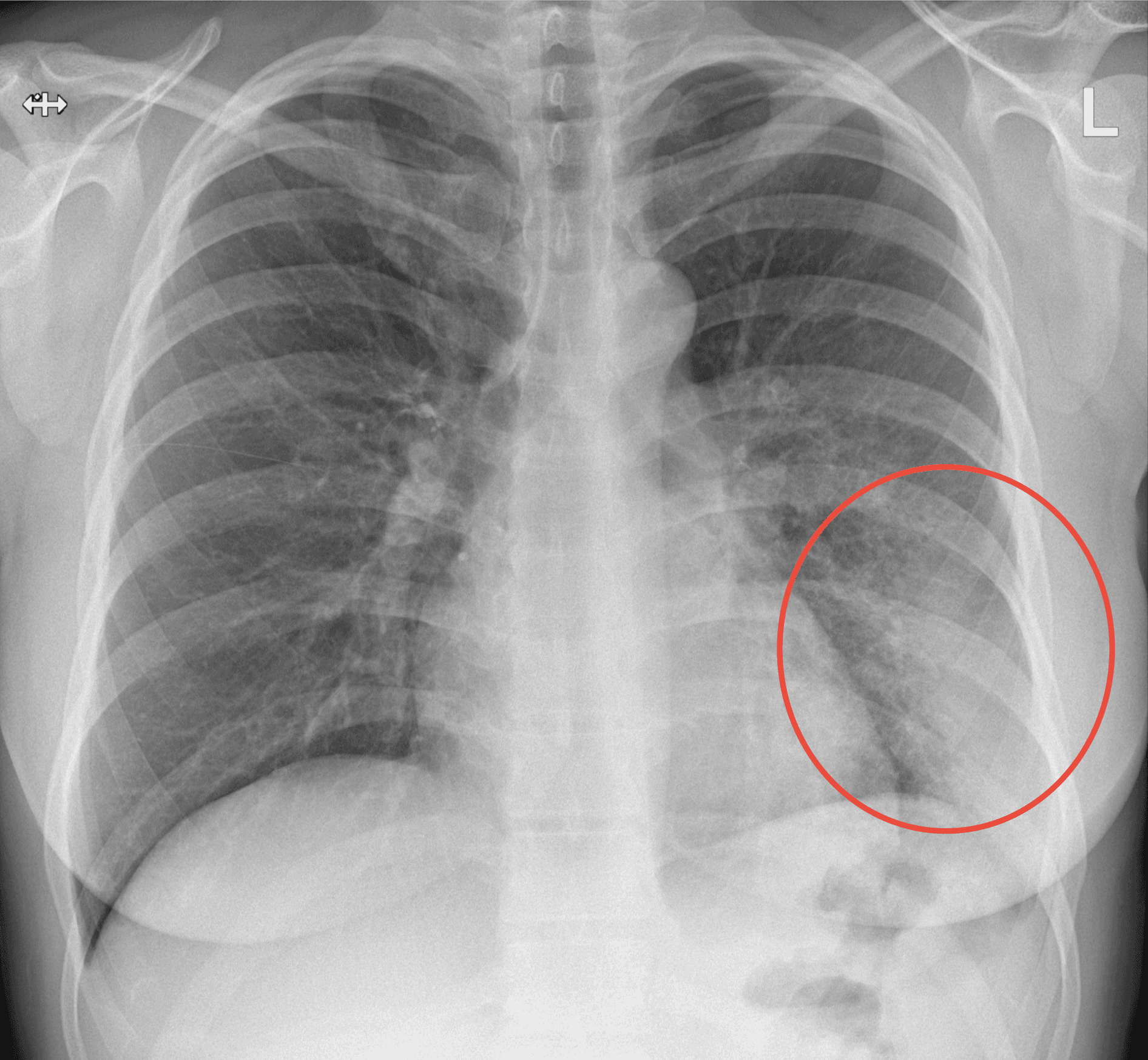 X-ray scan 2