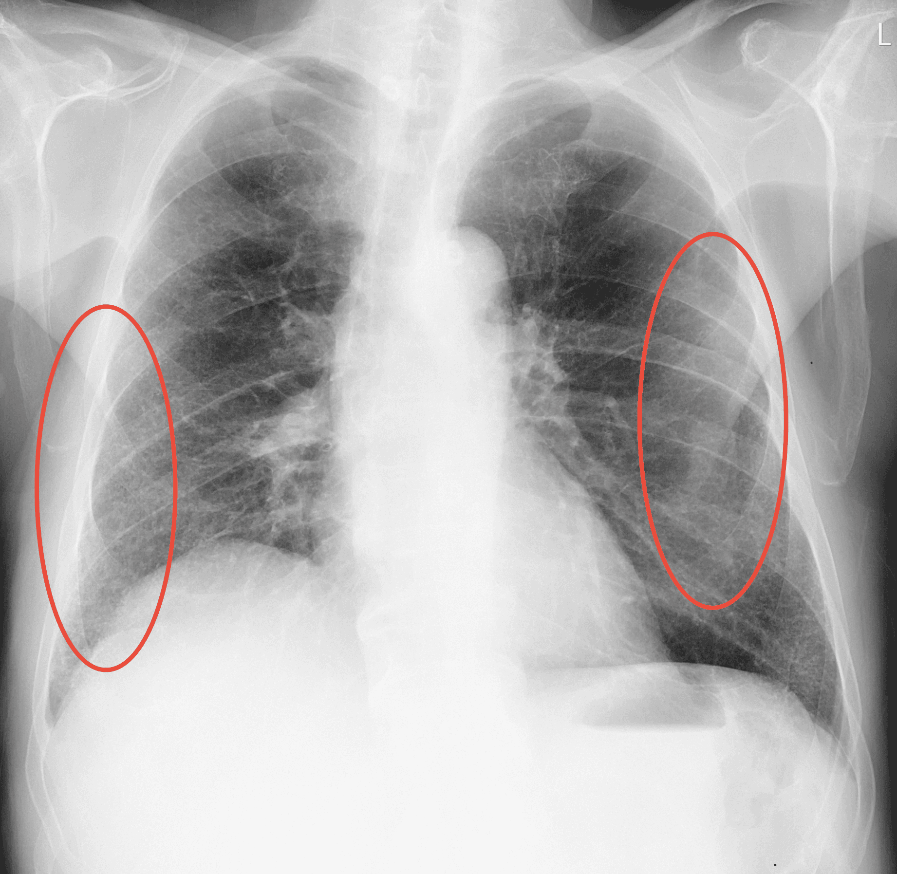 X-ray scan 1