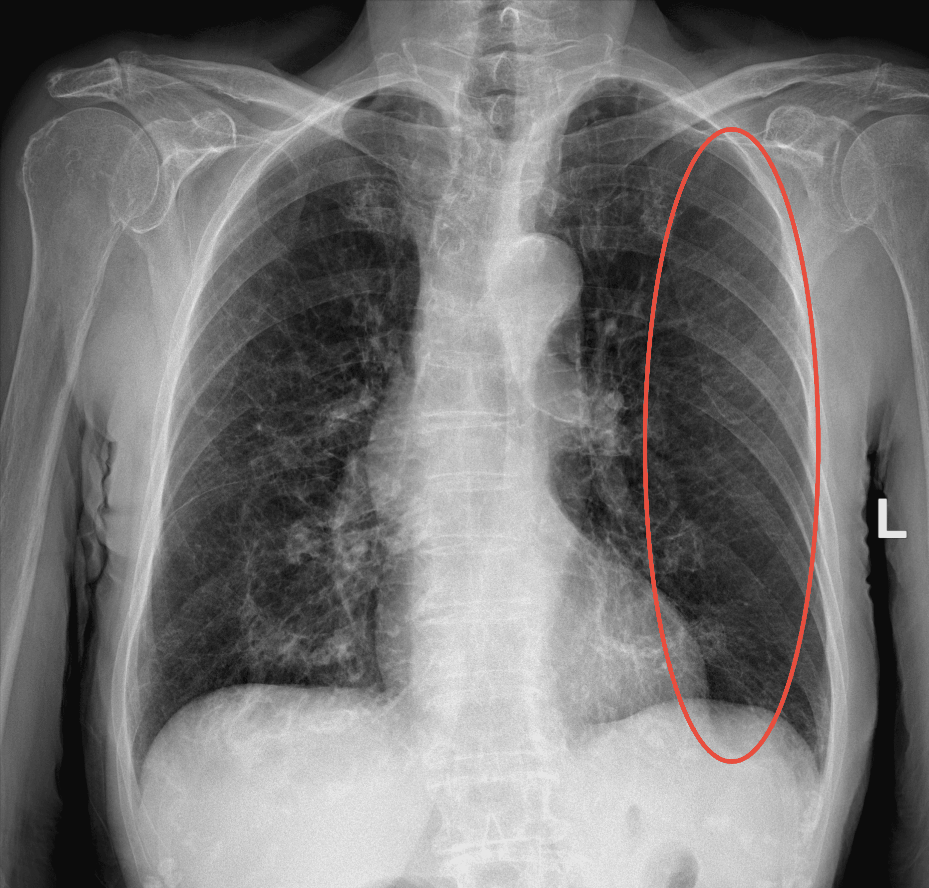 X-ray scan 3