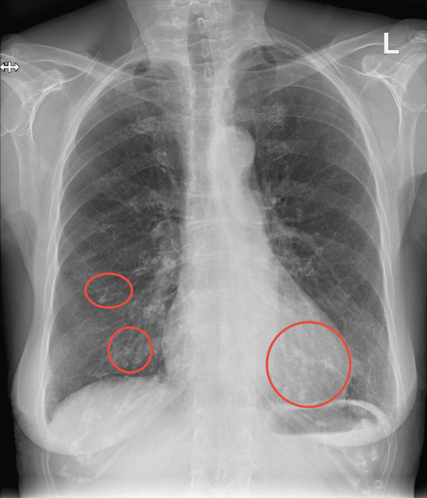 X-ray scan 4