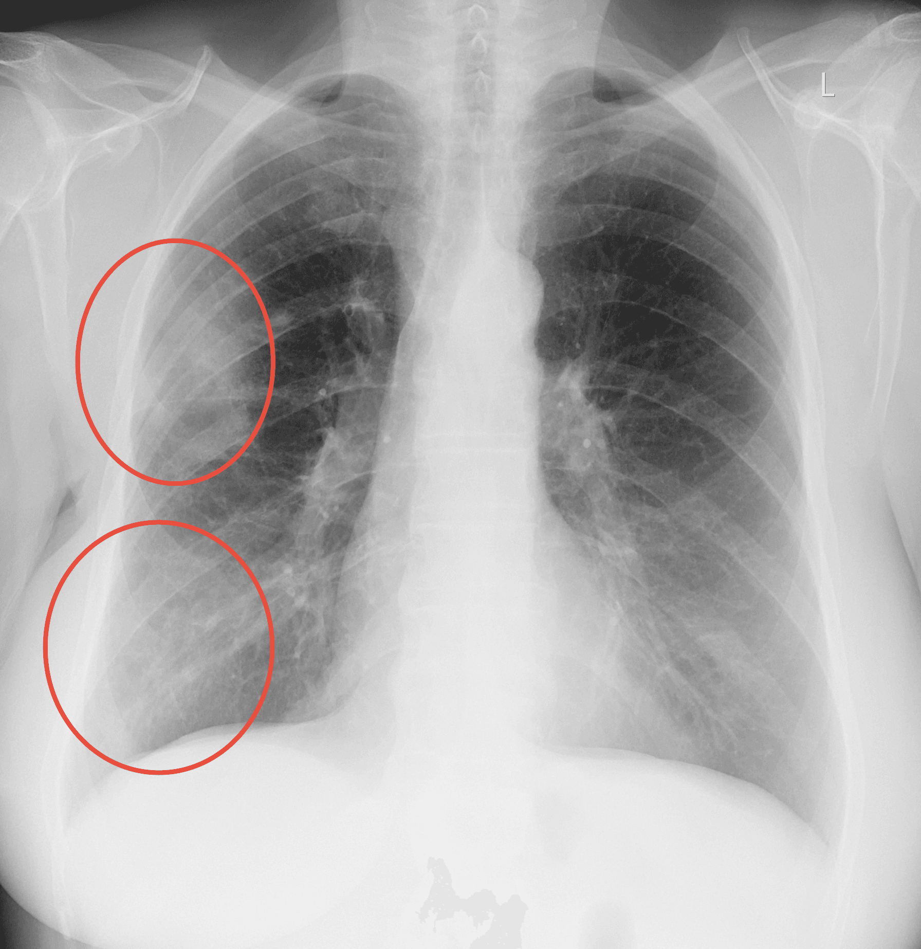 X-ray scan 5